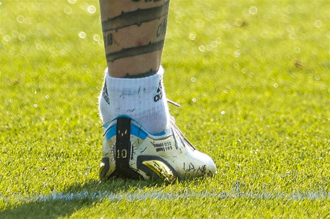 <p>Detalle del tobillo hinchado del delantero argentino Lionel Messi durante un entrenamiento de su selección este lunes en el campo de fútbol de la Universidad de Catar en la víspera del debut de Argentina en el Mundial Qatar 2022. Argentina se enfrentará el 22 de noviembre a Arabia Saudí en el estadio Lusail. EFE/Juan Ignacio Roncoroni</p>